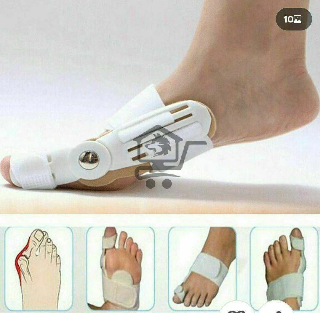 جهاز تصحيح عظمة الابهام - الصورة 3