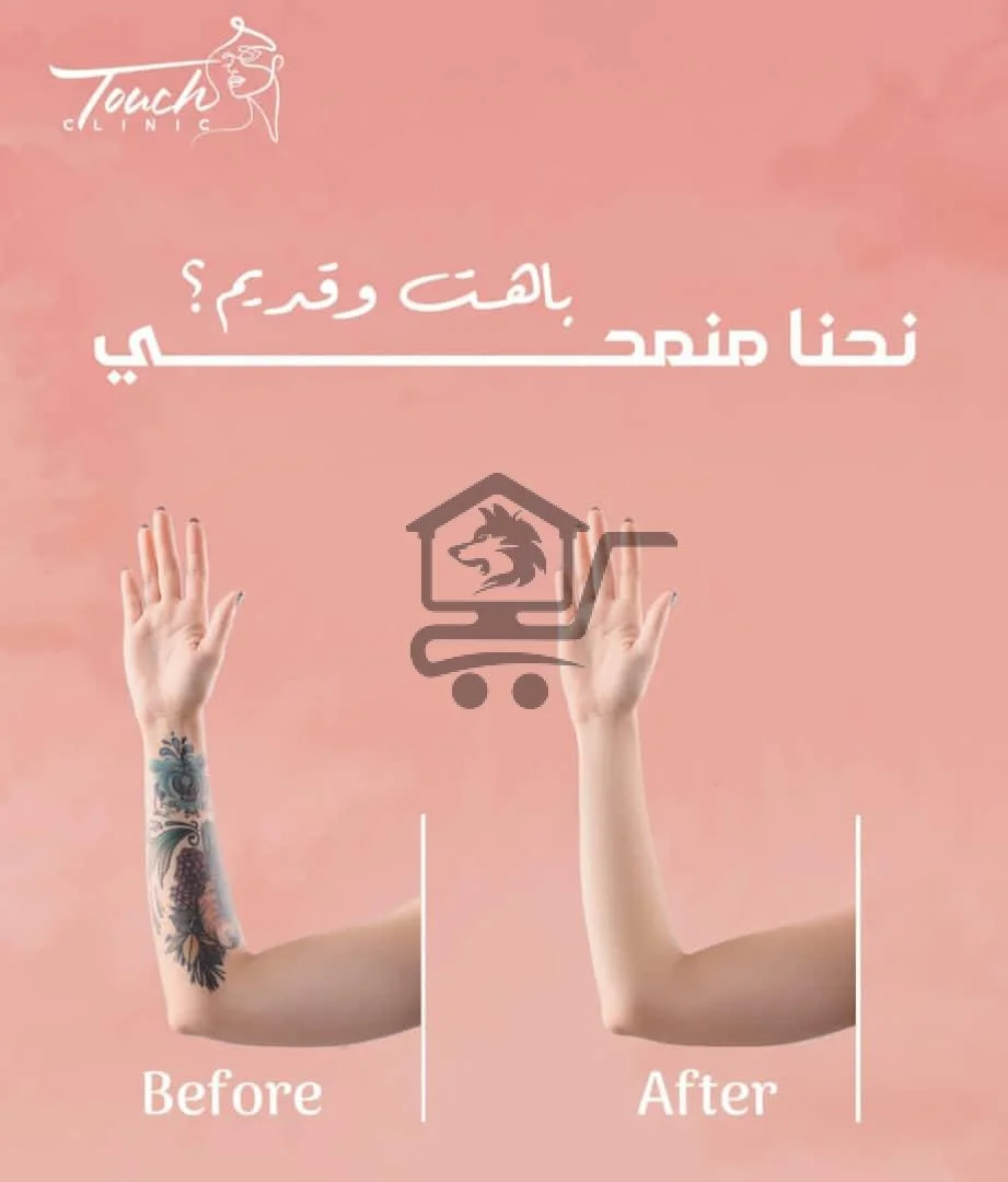 🌸  مع  Touch Clinic جمالك على أصوله   🌸 - الصورة 4
