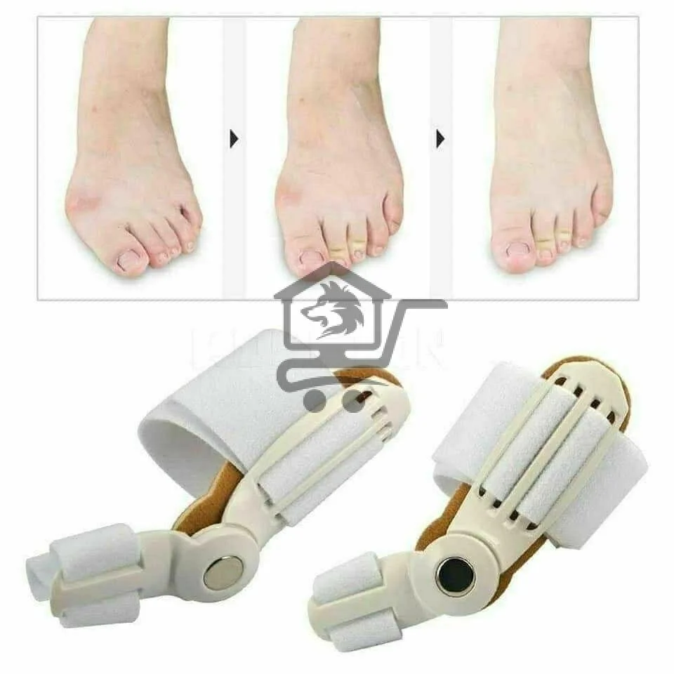 جهاز تصحيح عظمة الابهام - الصورة 2