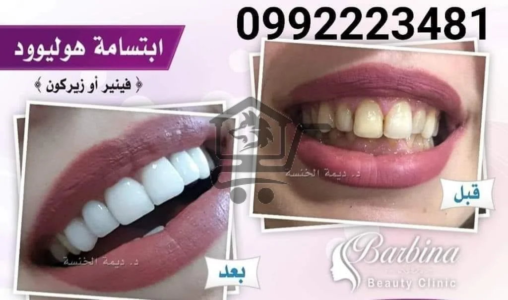 مركز باربينا - الصورة 5