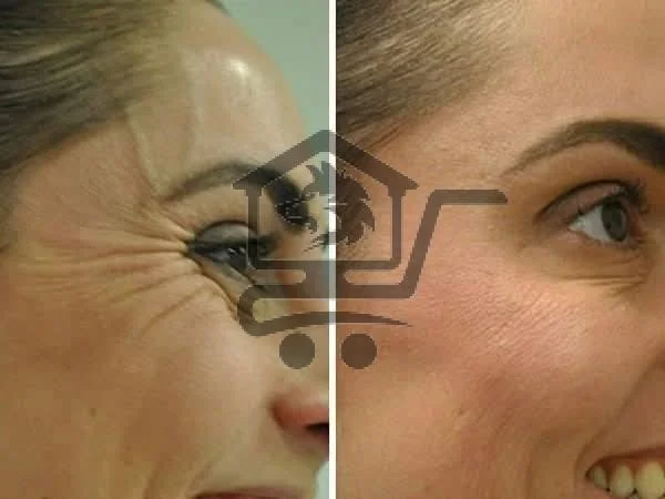 مركز ليزر و تجميل - الصورة 3