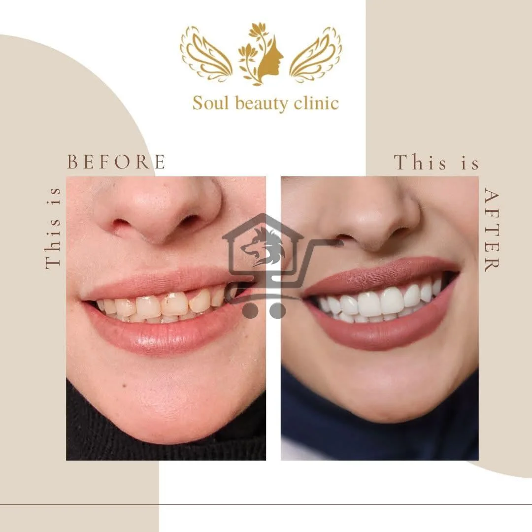 soulbeautyclinic - الصورة 4