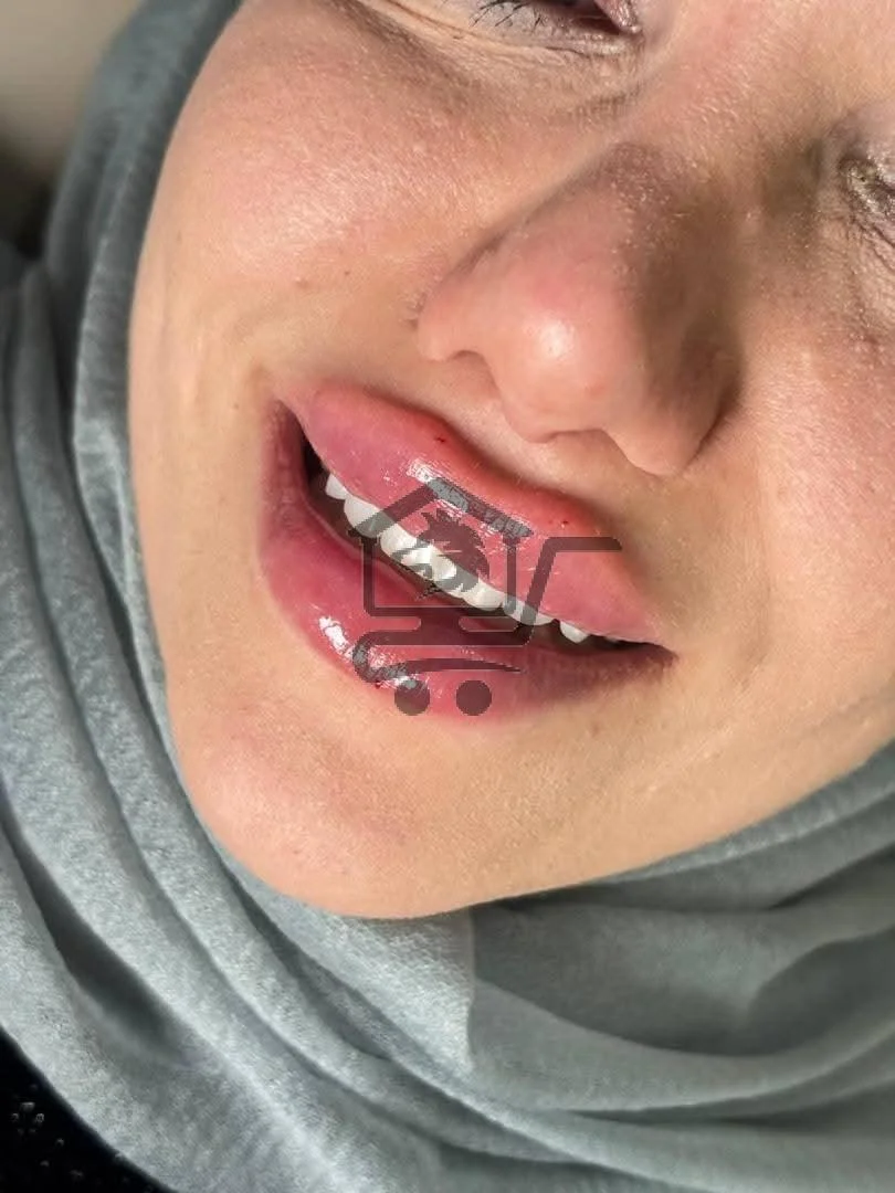 soulbeautyclinic - الصورة 2