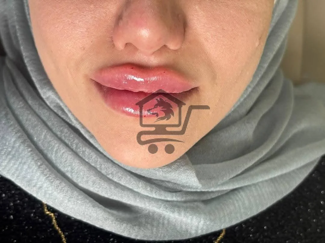 soulbeautyclinic - الصورة 3