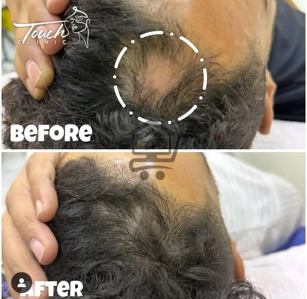 🌸  مع  Touch Clinic جمالك على أصوله   🌸 - الصورة 3