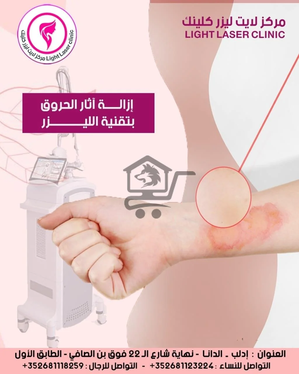 مركز لايت ليزر كلينك Light Laser clinic - الصورة 3