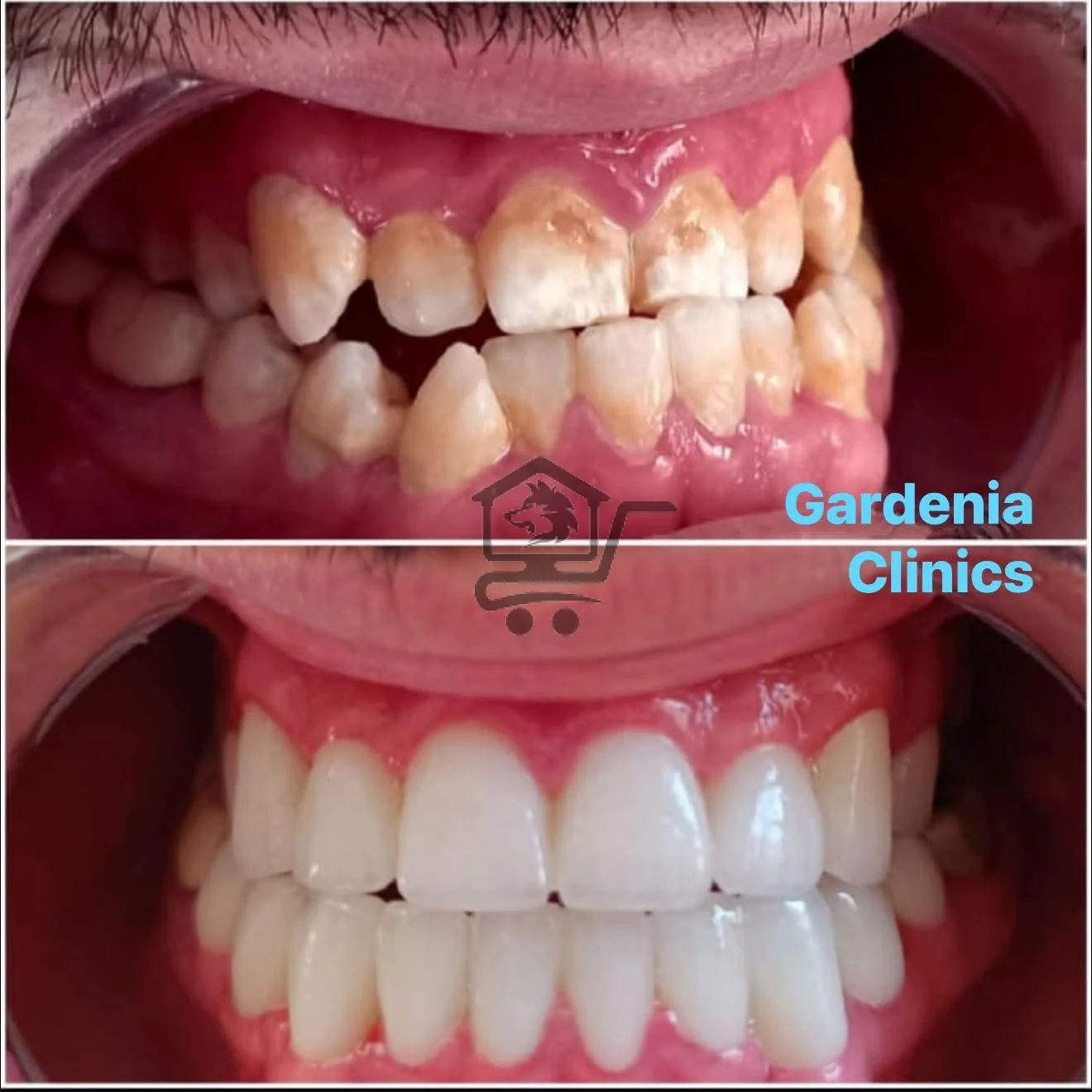 غاردينيا كلينك للأسنان - الصورة 3