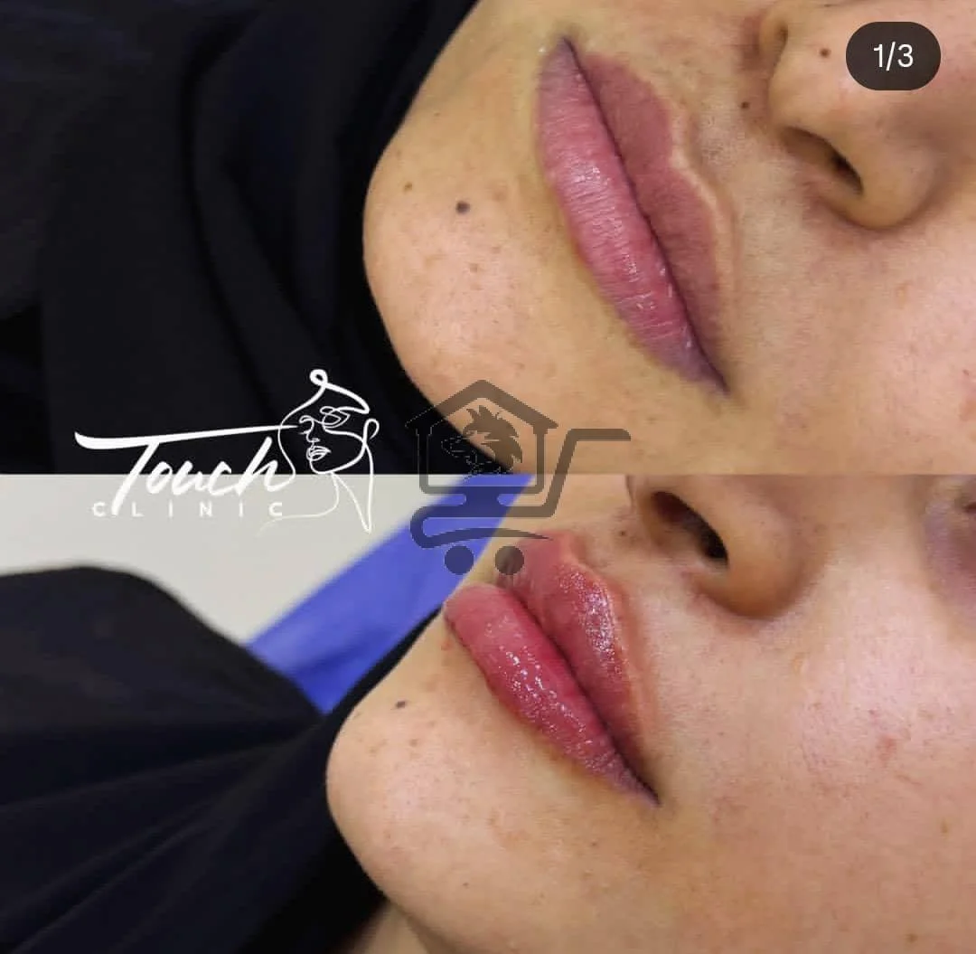 🌸  مع  Touch Clinic جمالك على أصوله   🌸 - الصورة 2