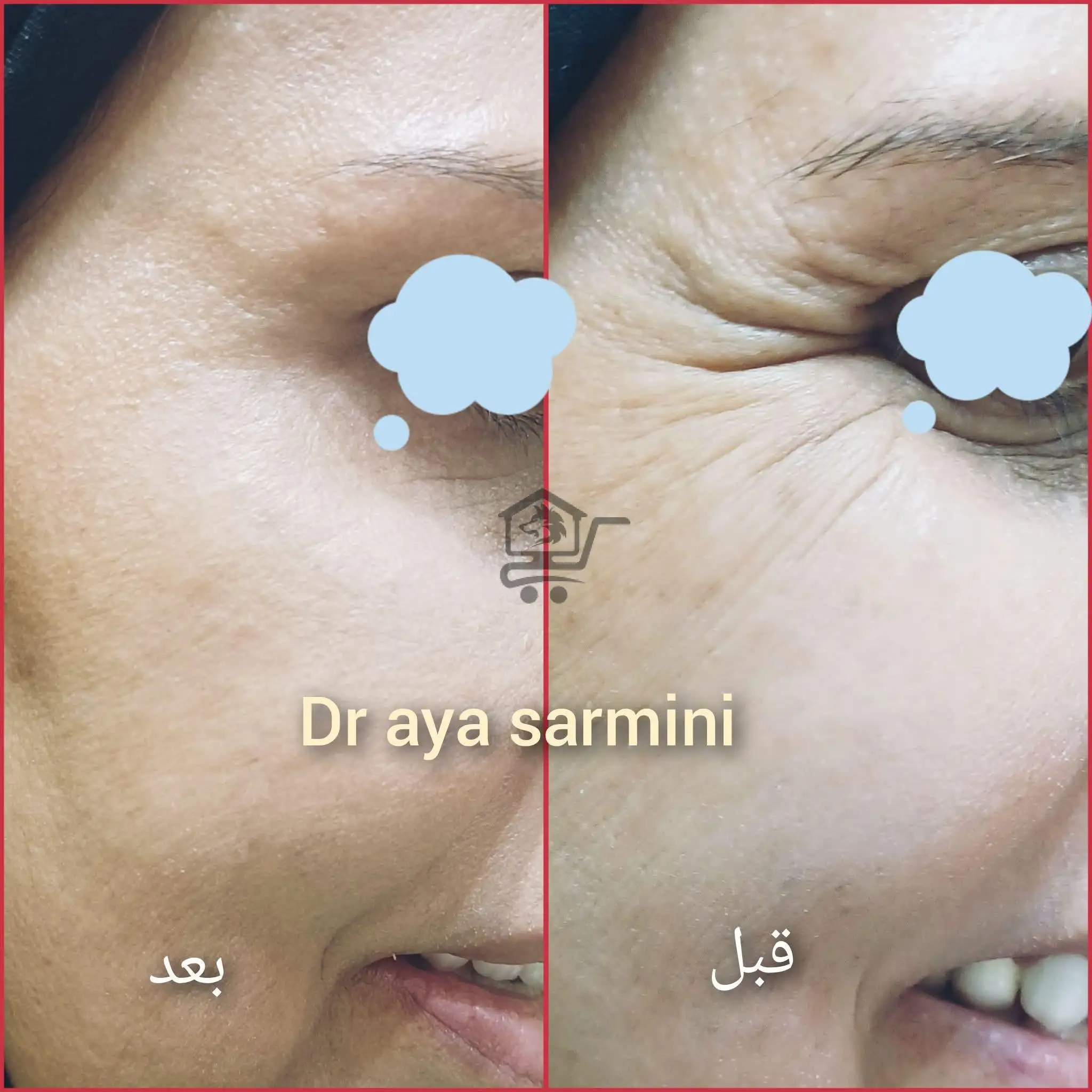 *  Bana_ laser_clinic * - الصورة 2