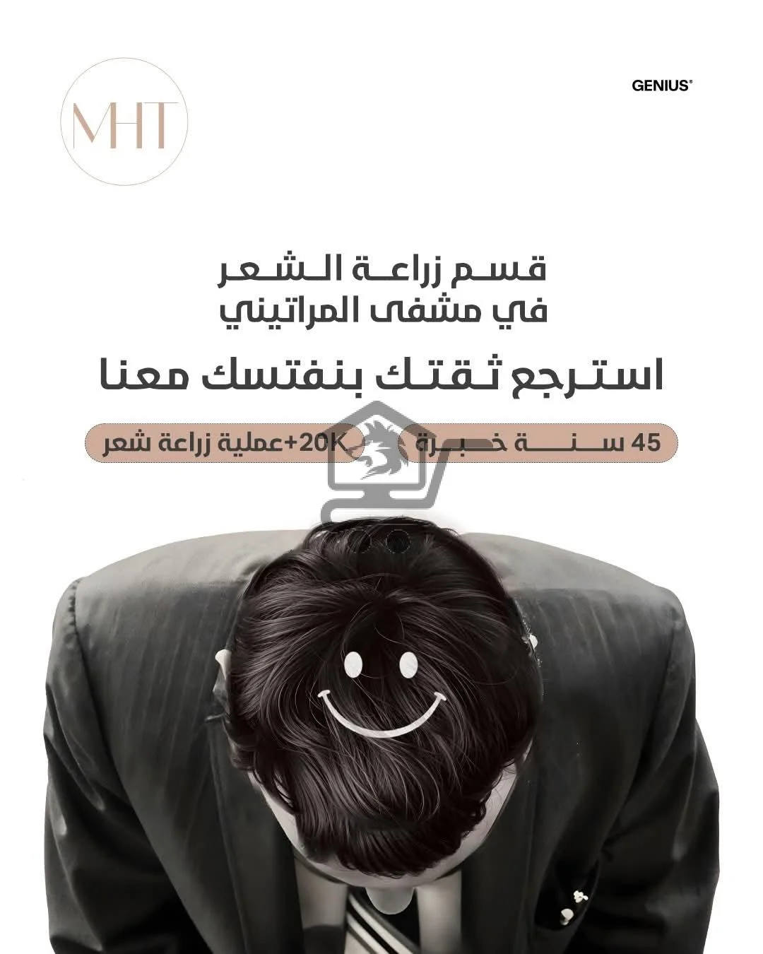 زراعة شعر - الصورة 3