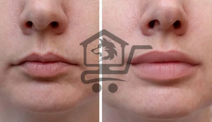 مركز ليزر و تجميل - الصورة 2