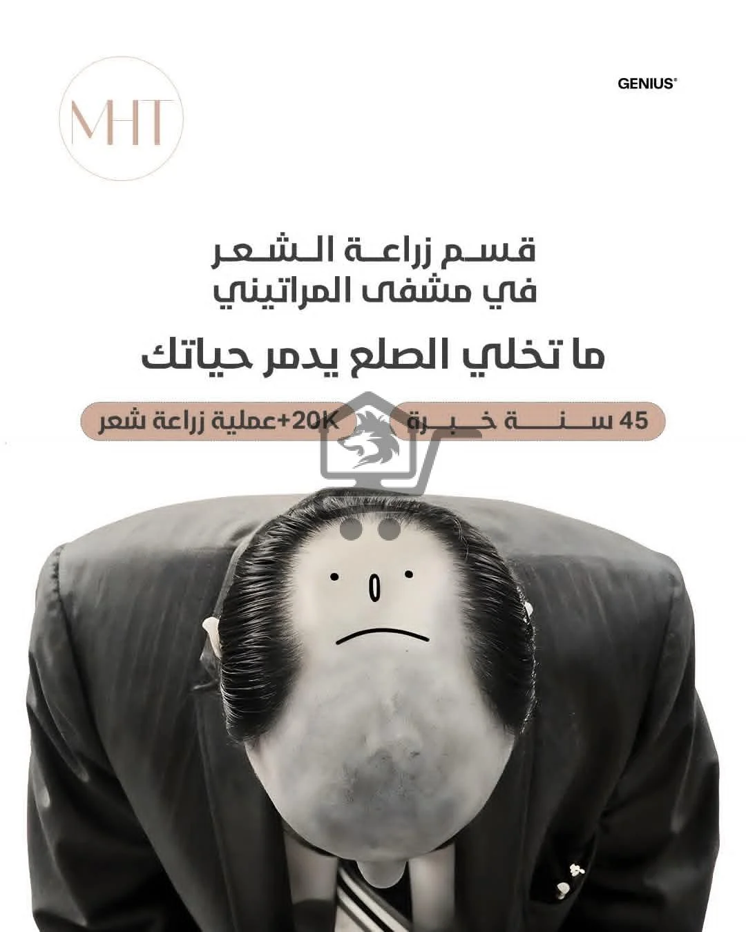 زراعة شعر - الصورة 2